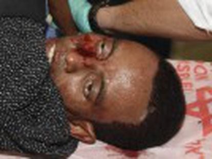 Eritreu foi agredido por multidão após ser baleado por guarda na sequência de um atentado na estação de ônibus de Beer Sheva