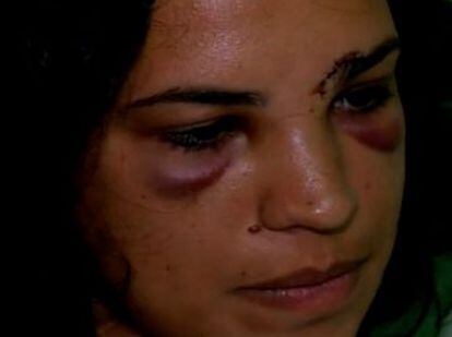 Ludmylla Valverde, agredida por dois homens em Irará.