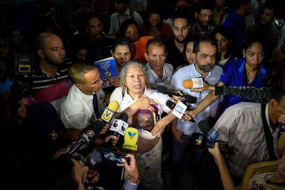 Elizabeth Salazar mostra seu seio esquerdo à imprensa venezuelana.