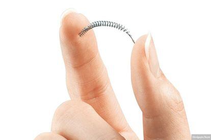 O Essure consiste em um par de molas de 4 centímetros cujo diâmetro pode se expandir de 1,5 a 2 milímetros para se fixar nas paredes das tubas uterinas