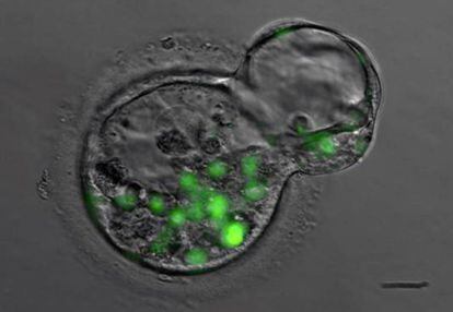 Embriões humanos no início do desenvolvimento.