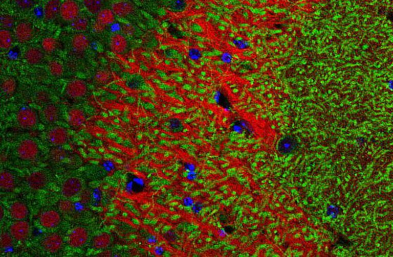 Detecção da proteína (em verde) do gene Crtc1 em neurônios do hipocampo de um camundongo.