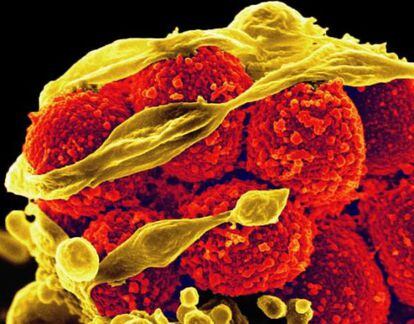 Em amarelo, a bactéria 'Staphylococcus aureus' escapa de um glóbulo branco.