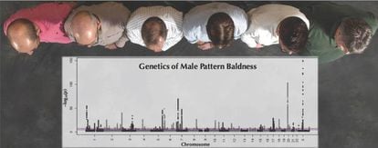Padrões genéticos da calvície em homens.