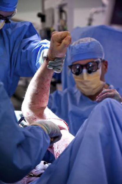 Os médicos conectam o braço do doador durante a cirurgia.