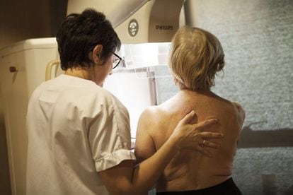 Mulher realiza uma mamografia em uma clínica francesa.