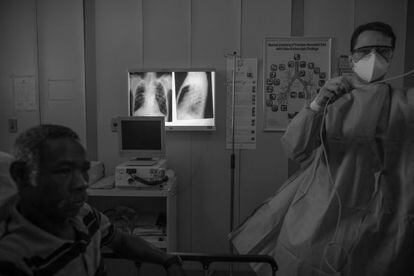 Um homem com tuberculose no Hospital Ary Parreiras, em Niterói.