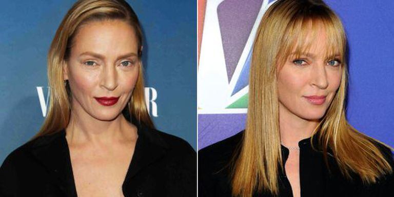 Uma Thurman depois de sua cirurgia (esquerda) e antes da operação.