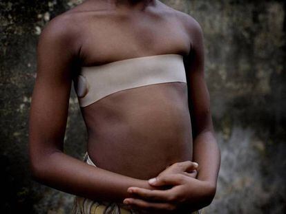 A tortura silenciosa para que as meninas africanas não se tornem mulheres