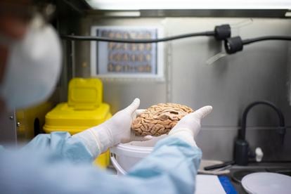 O patologista Alberto Rábano mostra um cérebro humano do Banco de Tecidos da Fundação CIEN.